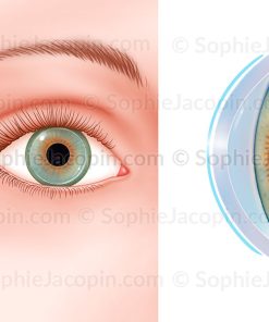 LENTILLE SOUPLE