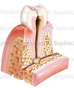 PATHOLOGIES BUCCO-DENTAIRES